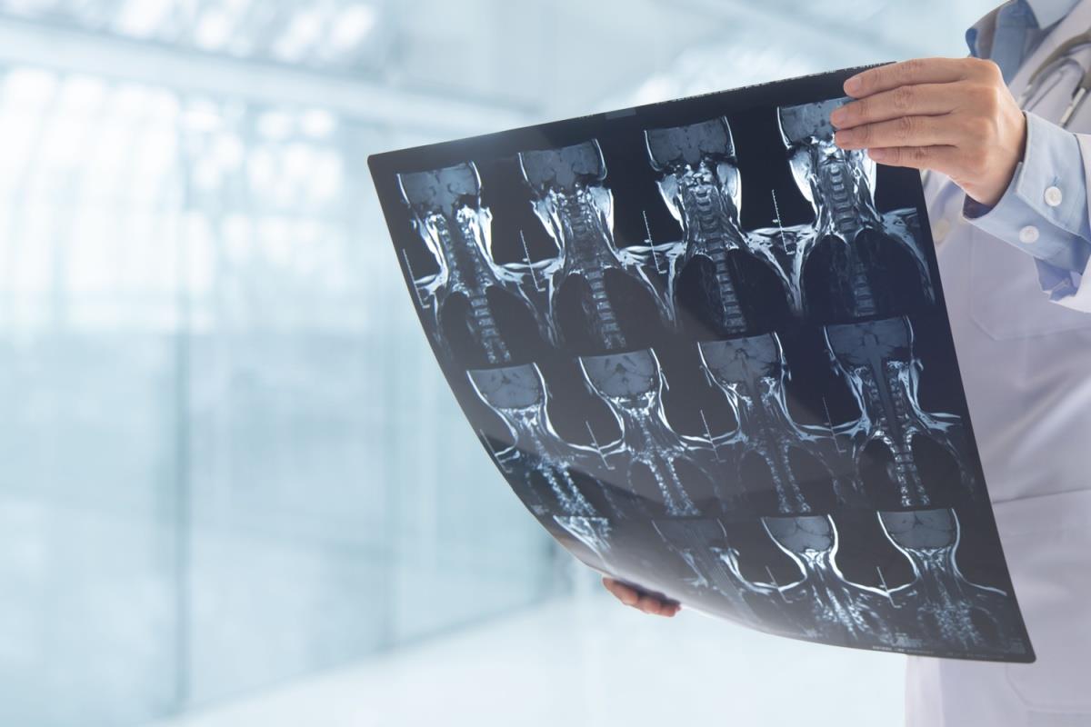 doctor ortoped examinand un CT